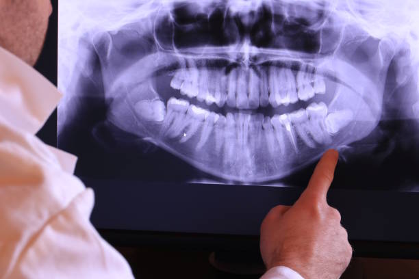 Best Dental Abscess Treatment in Rutherford, NJ